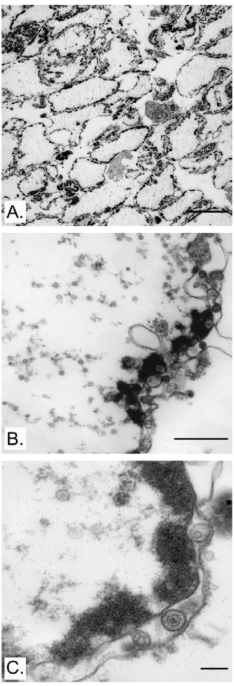 Purity And Integrity Of Isolated Nuclei Nuclei Isolated From Hsv