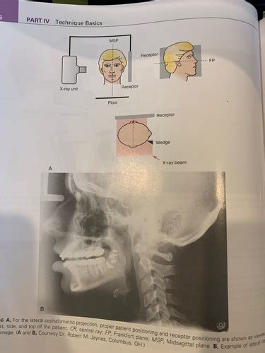 Radiology Quiz Ch Flashcards Quizlet