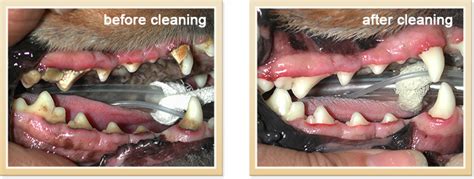 Teeth Cleaning Before And After