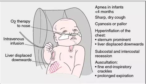 Pdf Pediatric Bronchiolitis