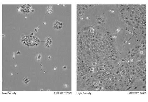 Human Pancreatic Adenocarcinoma In Situ Cell Line BxPC 3 Ubigene