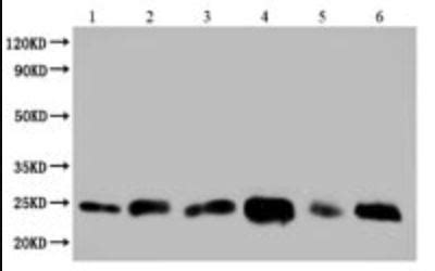 Exosome Isolation Kits - Immunology and Cancer Biology University of California