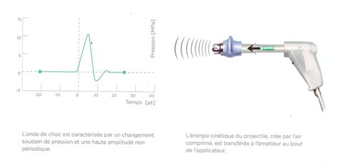 Ondes De Chocs Radiales Dr Yves ROUXEL