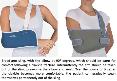 Clavicle Fracture Sling