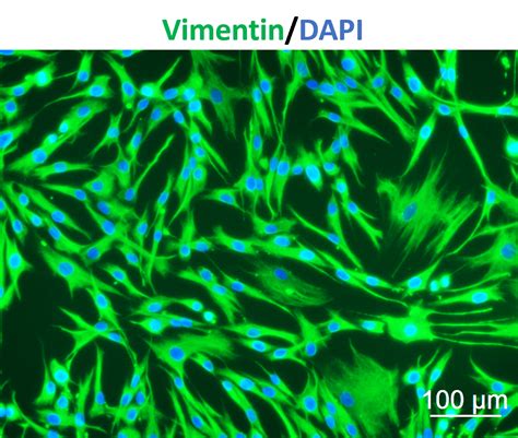 Human Pulmonary Fibroblasts Hpf Ixcells