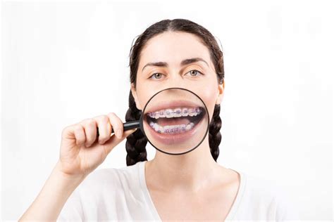 Tips For Dental Care For Patients With Braces