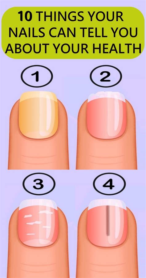 10 Things Your Nails Can Tell You About Your Health You Nailed It