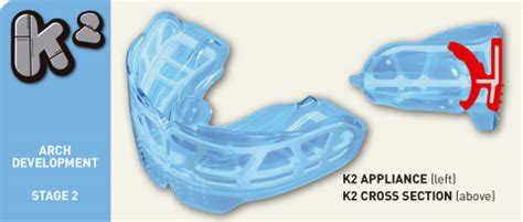 Myobrace K Pacific Orthodontics