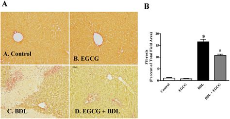 Effect Of EGCG On BDL Induced Liver Fibrosis In Mice BDL Caused