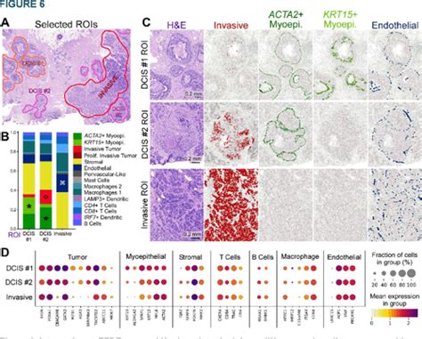 PDF High Resolution Mapping Of The Breast Cancer Tumor