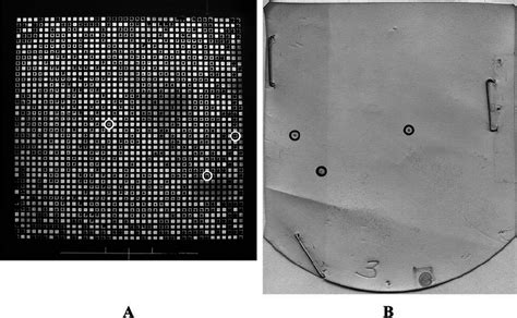 A Hgmf Containing C Perfringens Growth After Incubation On Tsc Agar