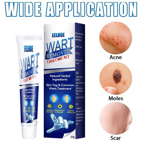 Warts Remover Original Cream Wart Removal Ointment Wart Treatment Skin Tags Mole Remover Cream