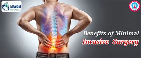 Benefits Of Minimal Invasive Surgery