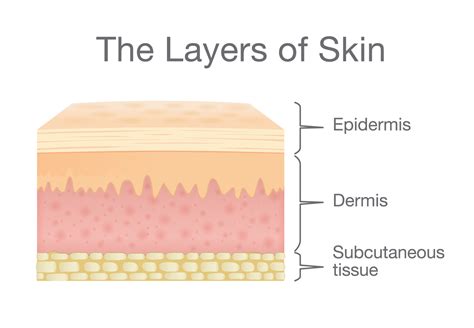 Understanding Eczema