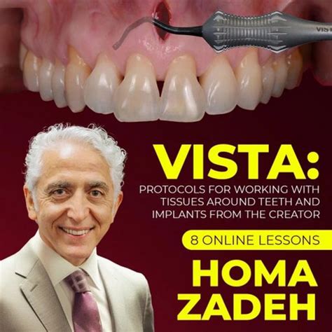 Vista Technique Protocols For Working With Tissues Around Teeth And