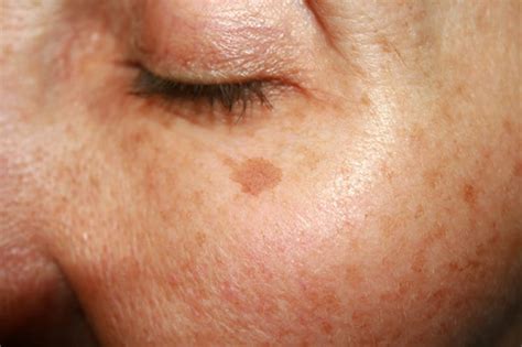 The 10 Most Common Signs Of Aging Skin And How To Reverse Them