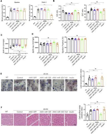 华中同济医院最新糖尿病心肌病 DCMP 模式动物实验发现MiR 320和CD36正反馈回路