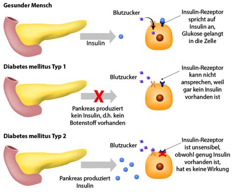 Diabetes Mellitus Praxis F R Allgemeinmedizin