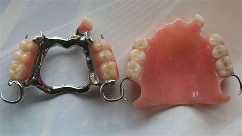 Full and Partial Dentures