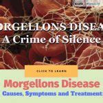 Morgellons Disease Causes Picture Symptoms And Treatment