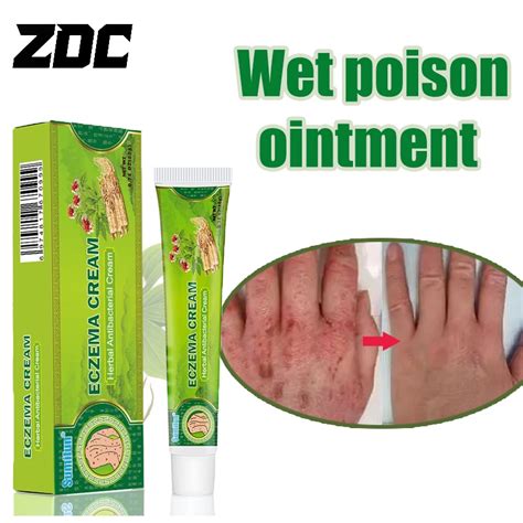 Zdc Wet Poison Qing Ointment For Eczema Heat Rash Itching And Other Skin Antibacterial Ointment