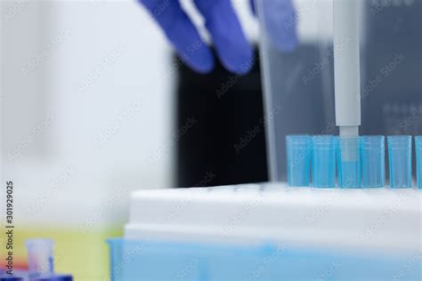 Polymerase Chain Reaction (PCR) and Agarose gel electrophoresis is a ...