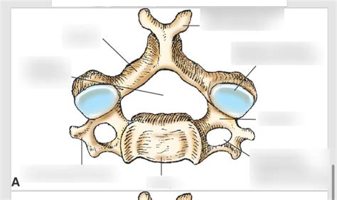 Typical C spine Diagram | Quizlet