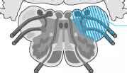 Brain Stem Vascular Syndromes Multiple Sclerosis Mussen Healthcare