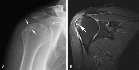 Approach To The Shoulder Clinical Tree