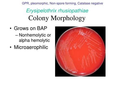 Ppt Aerobic Gram Positive Bacilli Part Ii Powerpoint Presentation