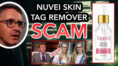 Nuvei Skin Tag Remover Serum Shark Tank Scam And Reviews Explained