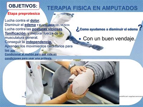 Terapia Fisica En Amputados Charla Pptx Ppt