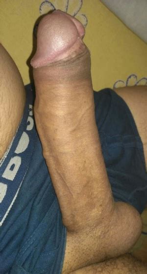 Uncut Foreskin Retracted Or In Its Normal Position Page 3 LPSG