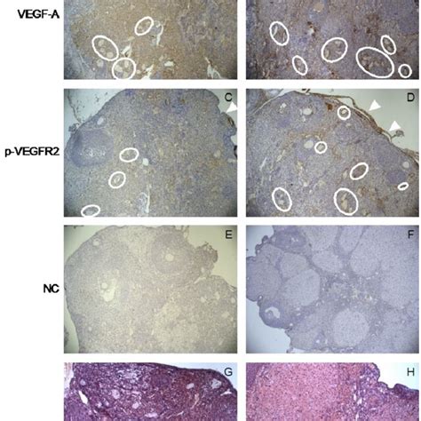 Tissue Localization Of Vegf A And P Vegfr2 In Mouse Ovaries