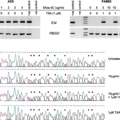 Restoration Of ID4 Expression In Gastric Cancer Cell Lines Accompanied