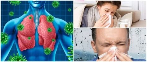 Infecciones Respiratorias Agudas Neumon A Pleures A Tuberculosis E