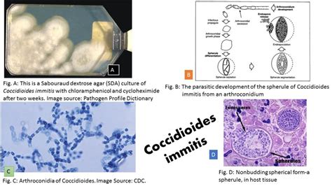 Coccidioides Immitis General Characteristics Pathogenesis Clinical Find