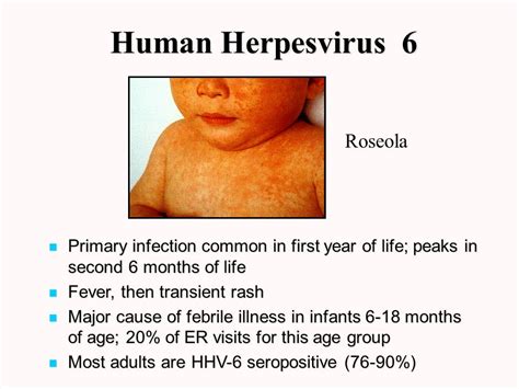 Pediatrics Notes Introduction To Herpesvirus Infection