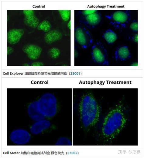 细胞自噬的分类，及关键过程 知乎
