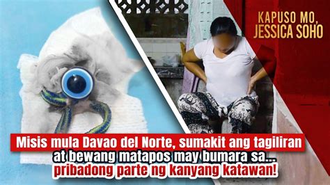 Misis May Bumara Sa Pribadong Parte Ng Kanyang Katawan Kapuso Mo