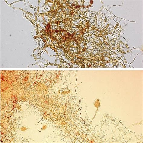 Fungal Mycelium Of Strains Jf1 Top With Branched Hyphae Constricted