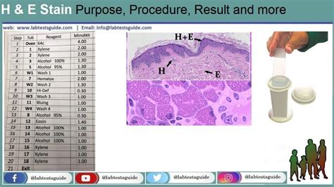 Hande Stain Purpose Procedure Result And More Lab Tests Guide