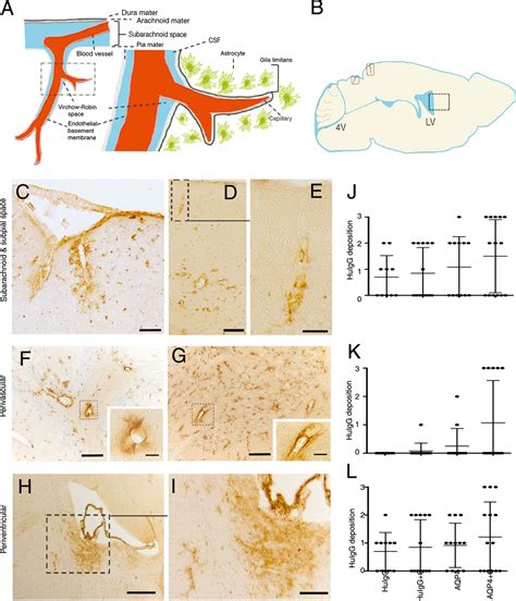 Cerebrospinal Fluid Aquaporin‐4‐immunoglobulin G Disrupts Blood Brain