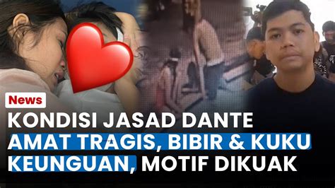 Tragis Kondisi Jasad Dante Memilukan Bibir Kuku Keunguan Akibat