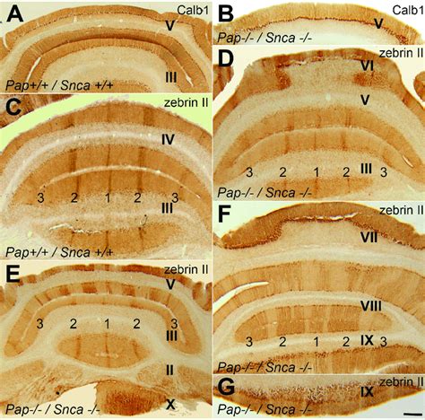 Transverse Sections Through The Adult Cerebellum Of Wt And Pap Null