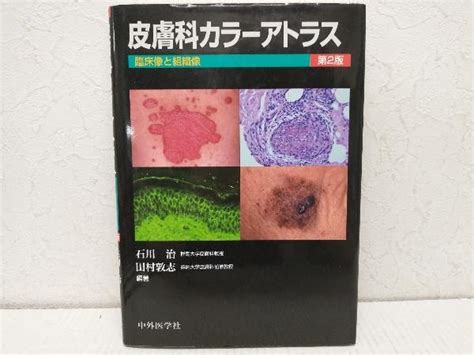 Yahooオークション 皮膚科カラーアトラス 臨床像と組織像 第2版 石川治