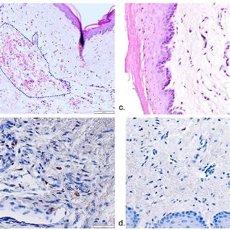 Representative Histological And Immunohistochemical Views Of Tissue Download Scientific Diagram