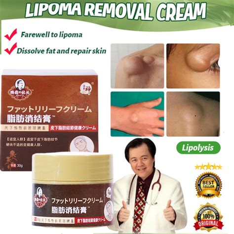 Imported From Japan Lipoma Removal Cream G Skin Lumps Dredge