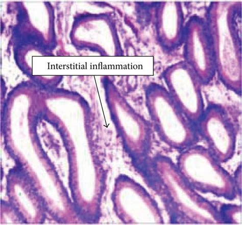 The Histological Examination Of Both Testicular And Epididymal Tissues