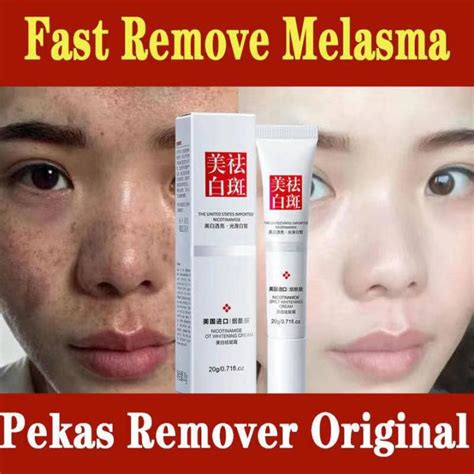 Anti Melasma Removal And Dark Spots Cream Effective Acne Scars 20g